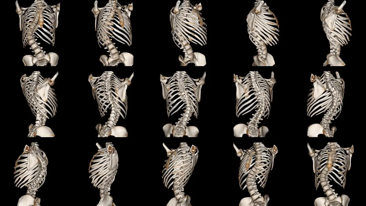 parenting tips how to correct bad posture in children