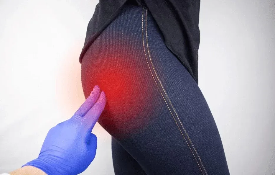 Sciatica Treatment in Singapore