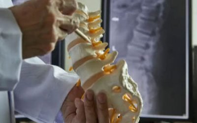What to Expect at the Chiropractor