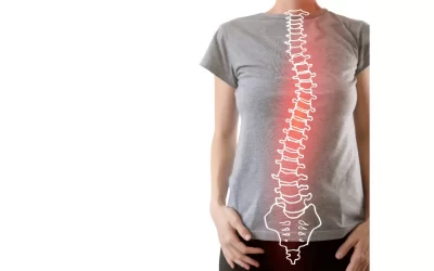 Experiencing Scoliosis? Here’s How Chiropractic Care Can Help