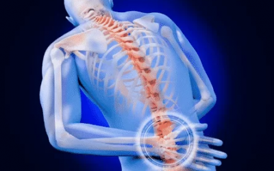 Slipped Disc: Causes, Symptoms & When to Seek Treatment